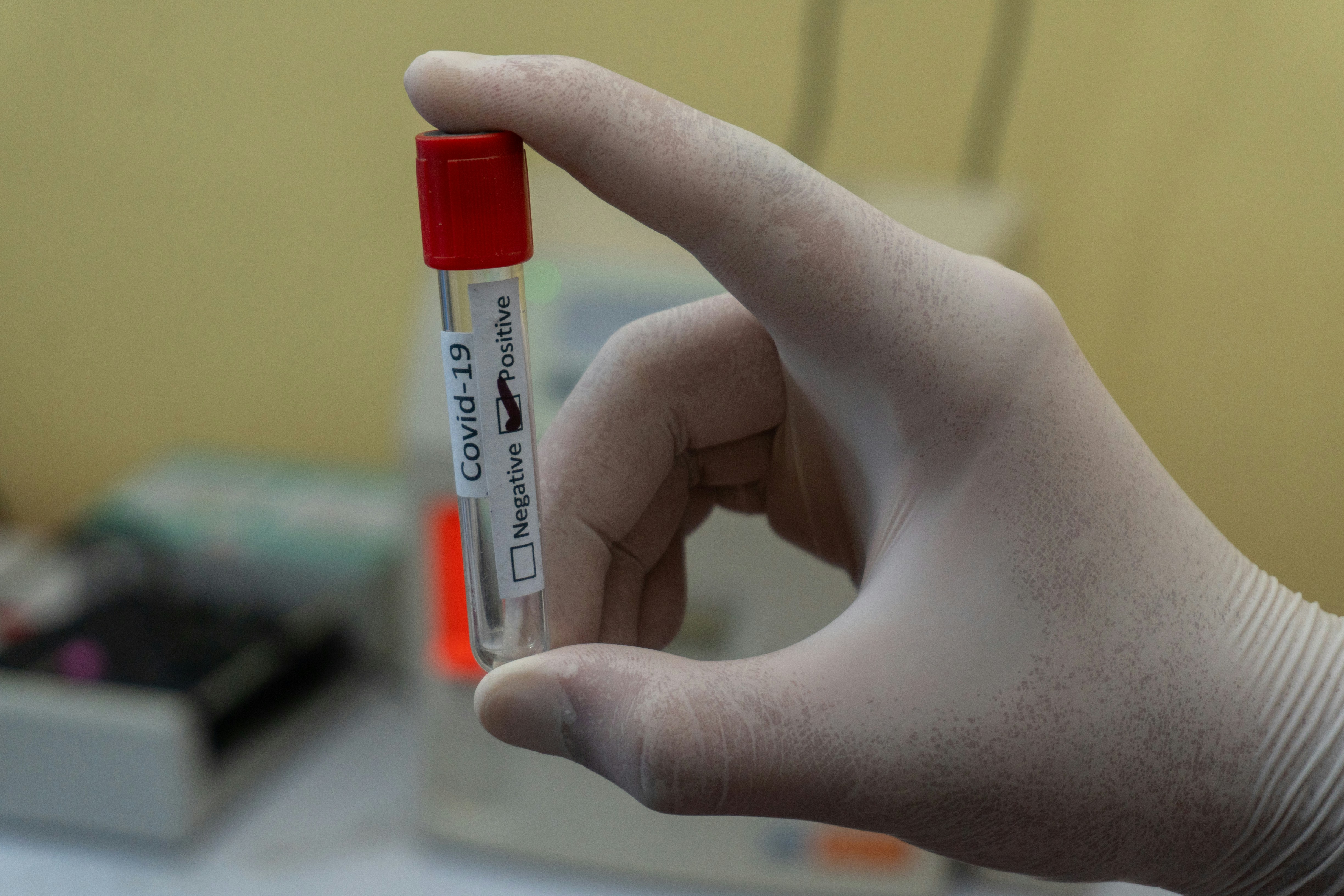 CDC Confirms Spread of New COVID-19 Variant NB.1.8.1 in U.S. Amid Surge in China